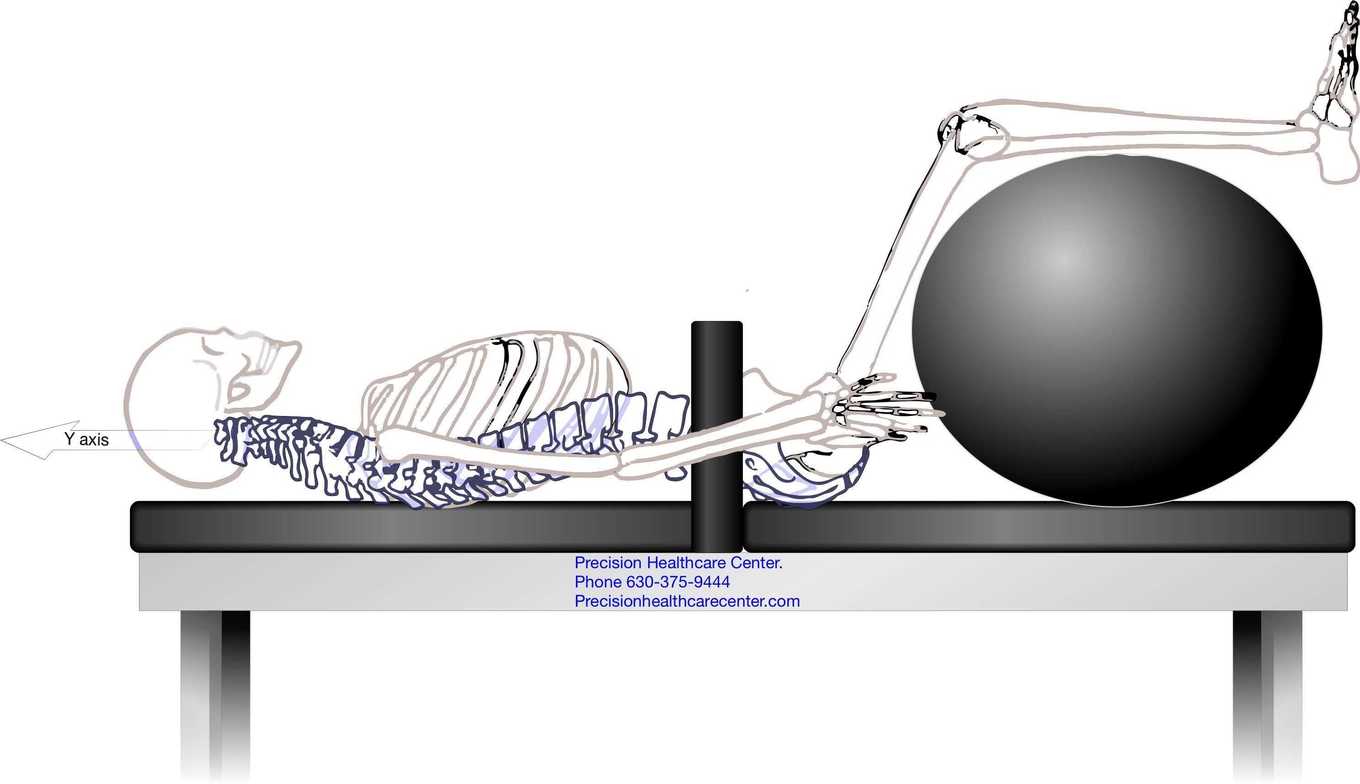 disc herniation, ring dinger, manual decompression, decompression, lumbar disc pain